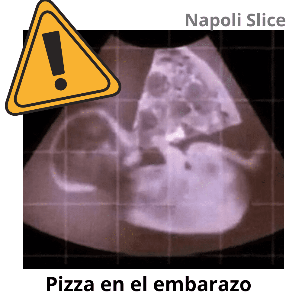 Puedo comer pizza si estoy embarazada